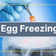 Egg Freezing Procedure
